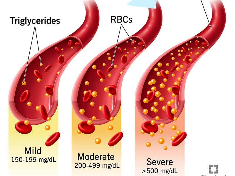 Triglycerides metabolic health