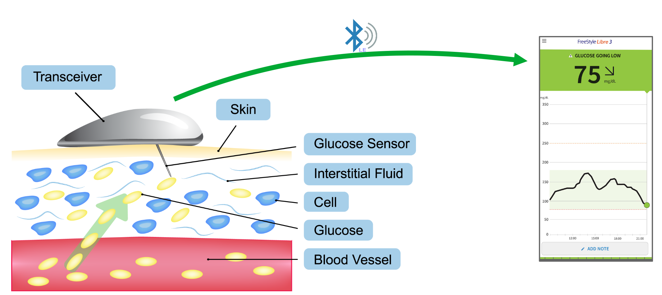 CGM flow diagram